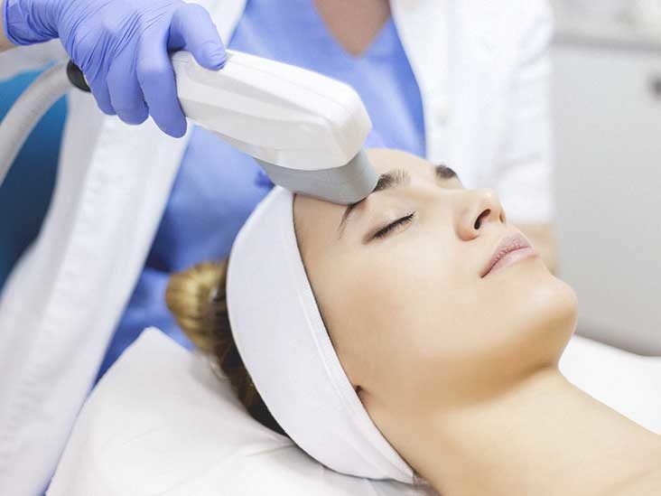 laser antiaging treatment