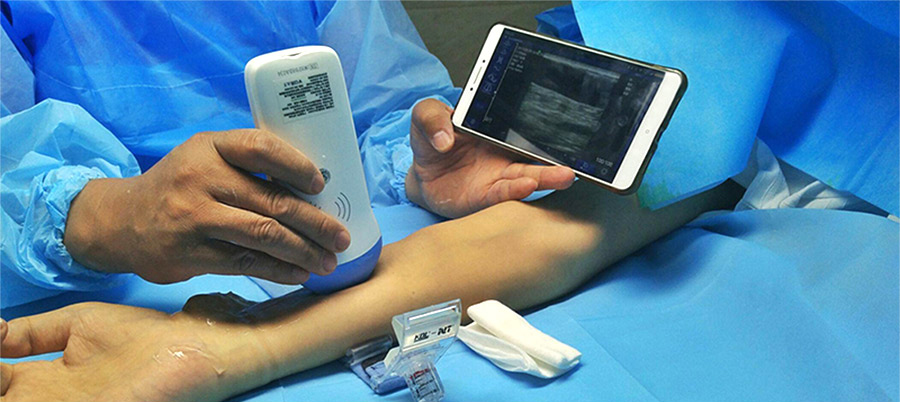 Handheld ultrasound machine