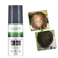 New Hair Growth Serum Spray - Anti Chute Cheveux for Men and Women1