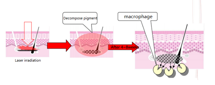 nanosecond laser working principle