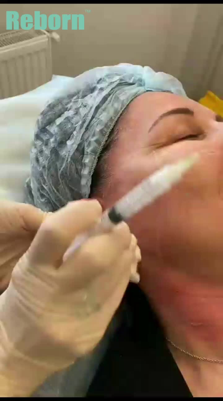 Reborn PLLA Filler para correção de ouvido