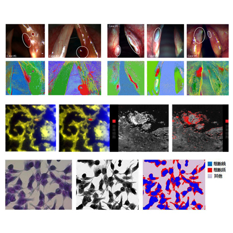 生物医学的領域