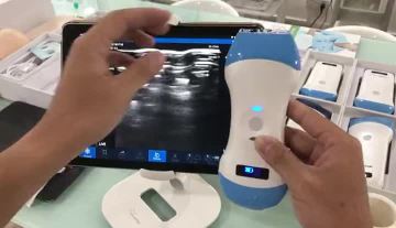 3 in 1 dual probe 2