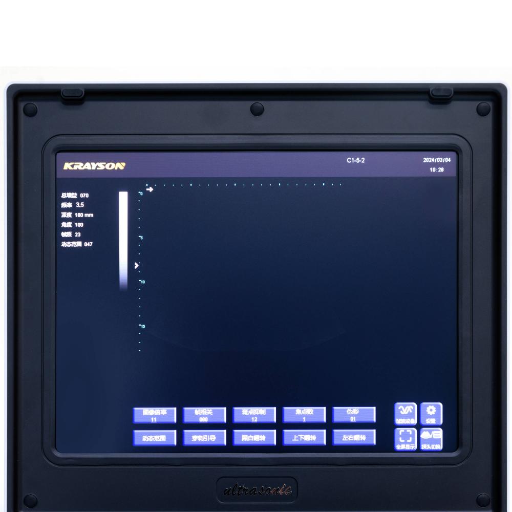Laptop Ultrasound Screen 1