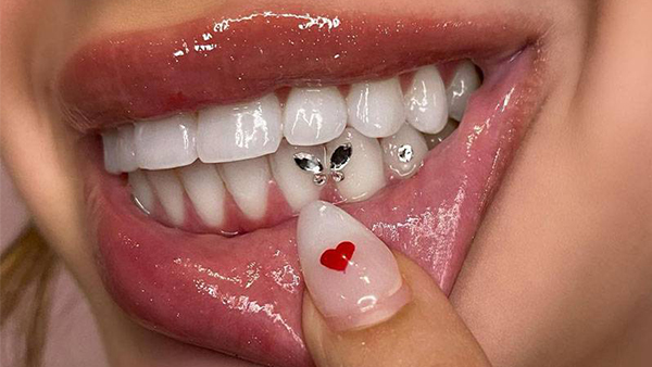 Cómo pegar sus propias gemas de dientes