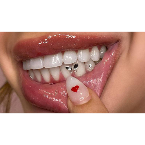 Come incollare le gemme dei denti
