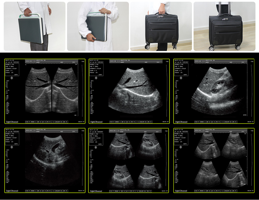 porket ultraosund system