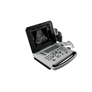 Top 10 Laptop Ultrasound Scanner Manufacturers