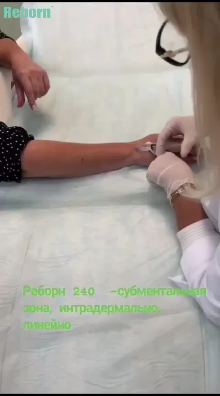 Reborn 240 мг PLLA Dermal Filler для лица и тела