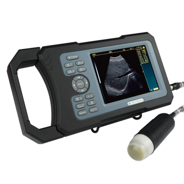 Asia's Top 10 Portable Ultrasound Machine Brand List