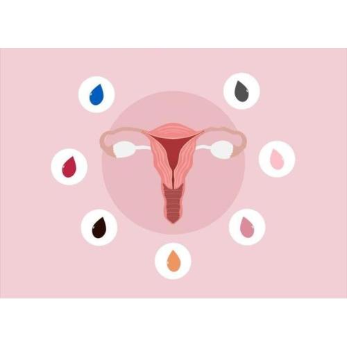 What color of menstrual blood is normal?