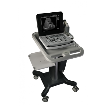 Ten Chinese Laptop Ultrasound Scanner Suppliers Popular in European and American Countries