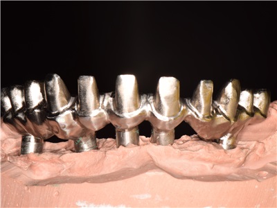 Mega Dental Lab