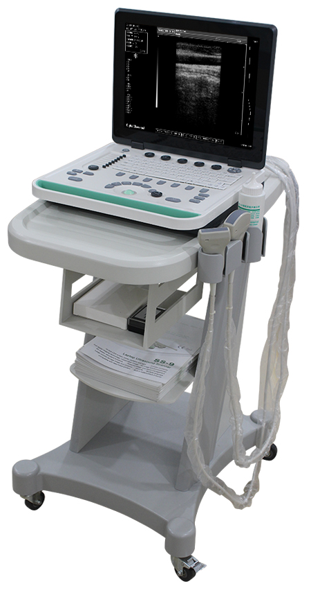 portable ultrasound system