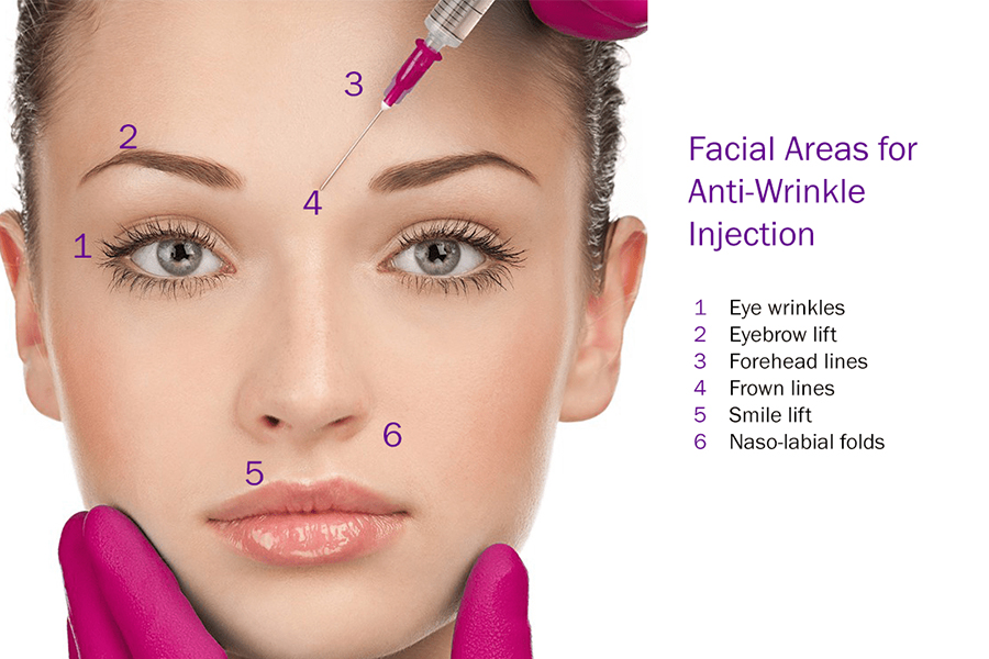 dermal filler injection