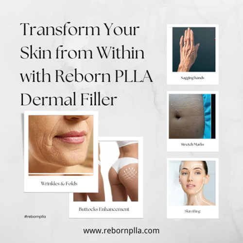 Reborn Plla Dermal Filler para rejuvenecimiento de las manos