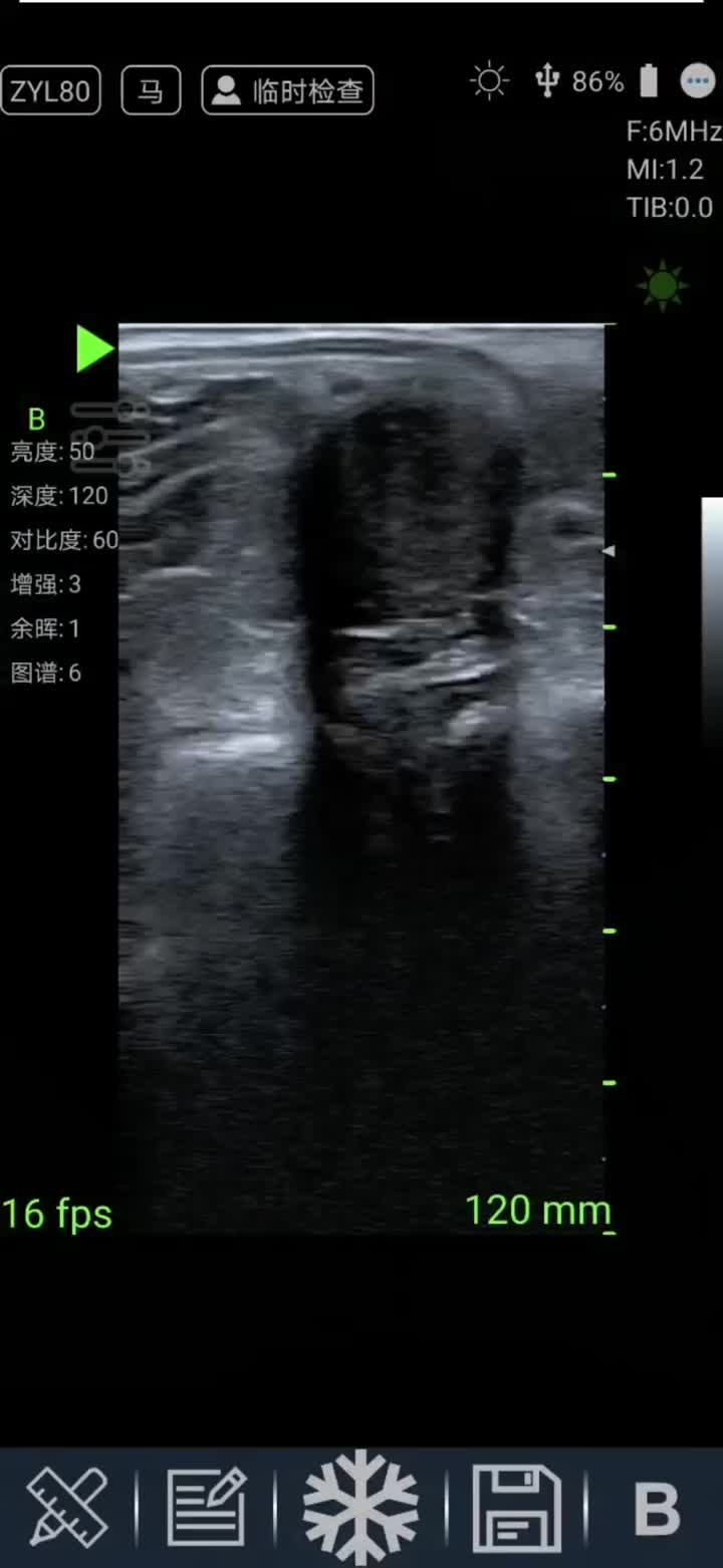 equine ultrasound machines