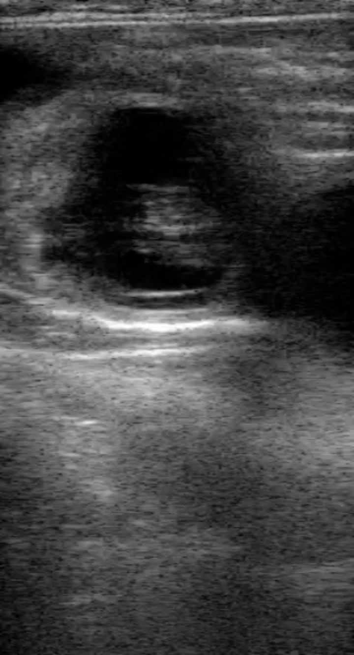 cattle ultrasound machine
