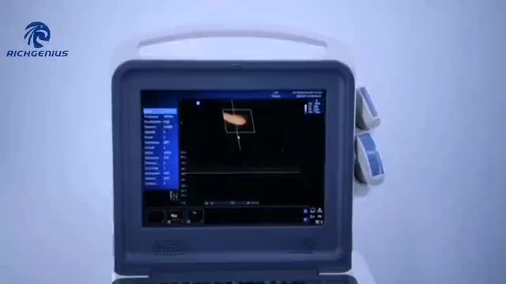 Vídeo colorido doppler k0