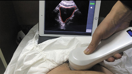 Portable Bladder ultrasound