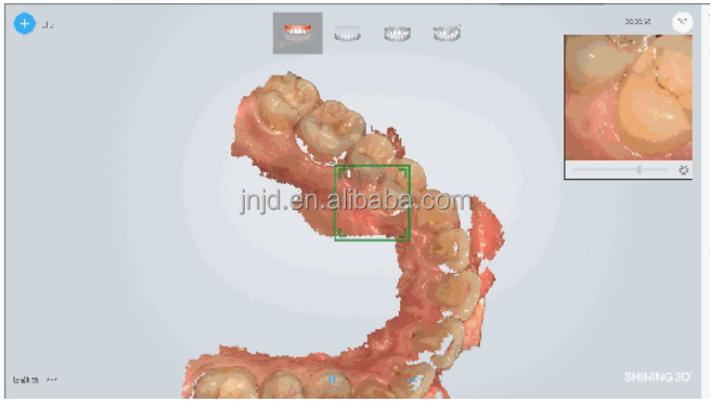 High Quality 3d Intraoral Scanners With High Accuracy And Light Weight ...