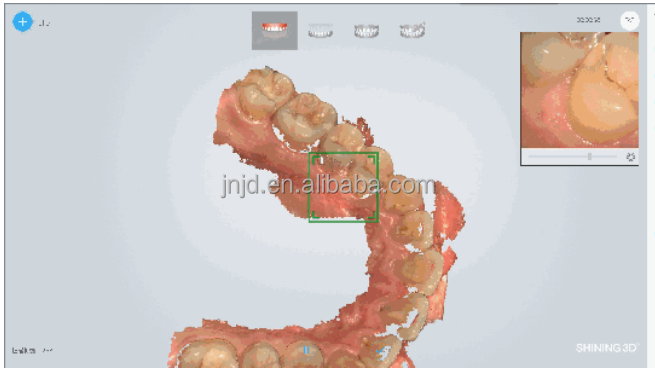 High quality 3d  intraoral scanners with high accuracy and light weight are suitable for dental clinics