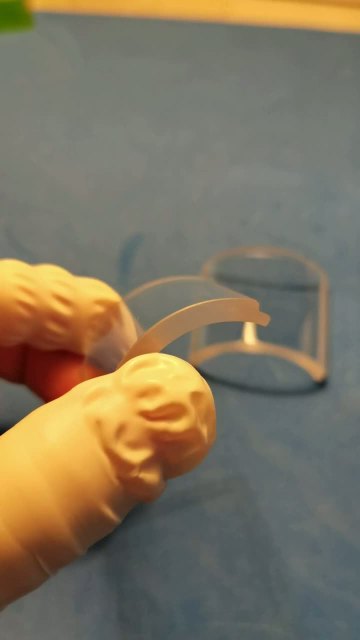 meniscus lens