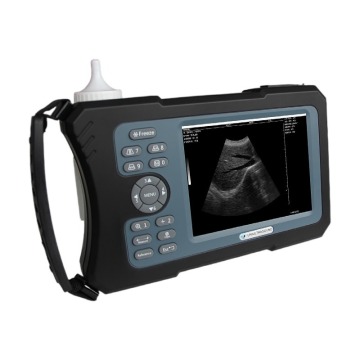 Top 10 Most Popular Chinese Handheld Ultrasound Scanner Brands