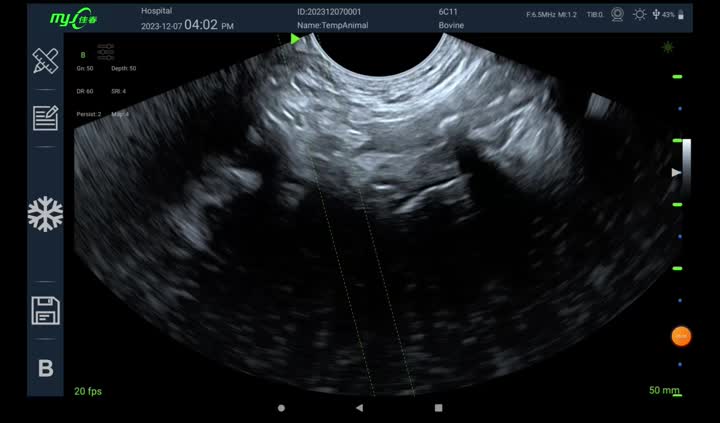 color ultrasound