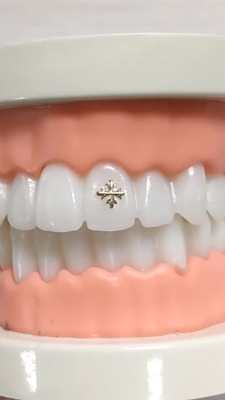 gemas de dente