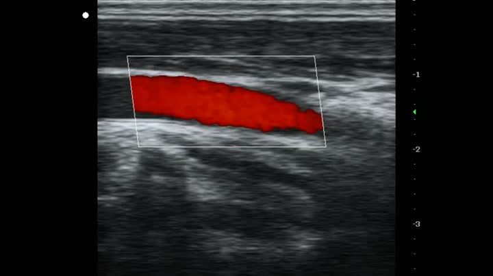 Дыягнастычная ўльтрагукавая машына