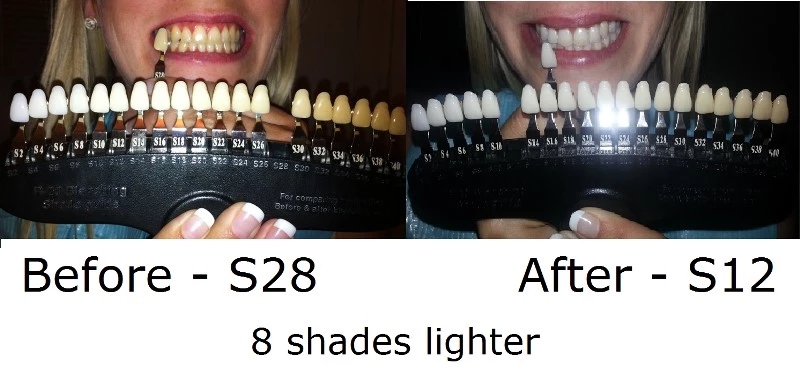 teeth-shade-guide.jpg
