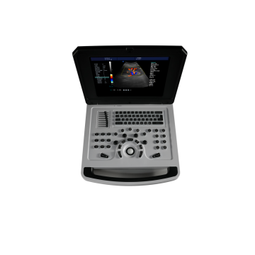 List of Top 10 Notebook Color Doppler Ultrasound Machine Brands Popular in European and American Countries