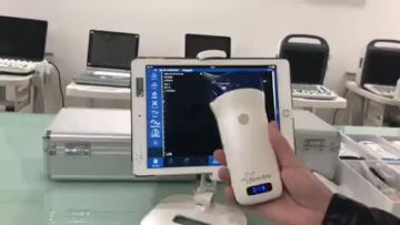 color convex probe
