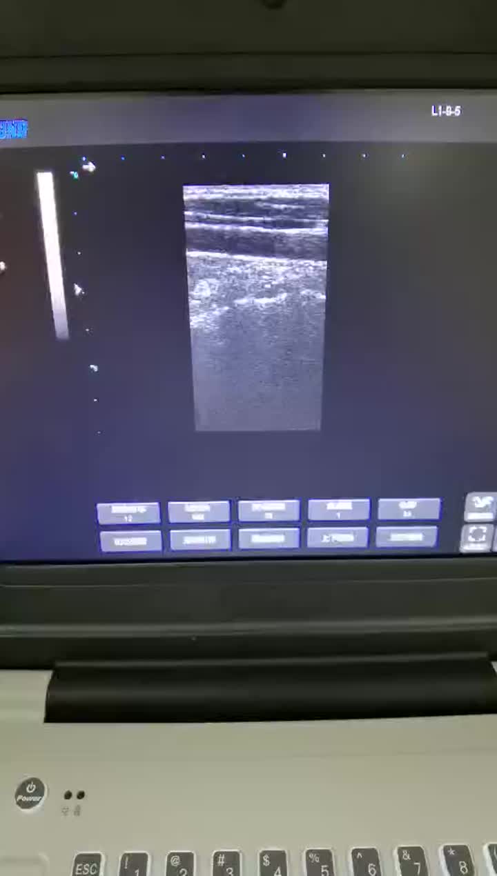 Video Ultrasound Laptop 5