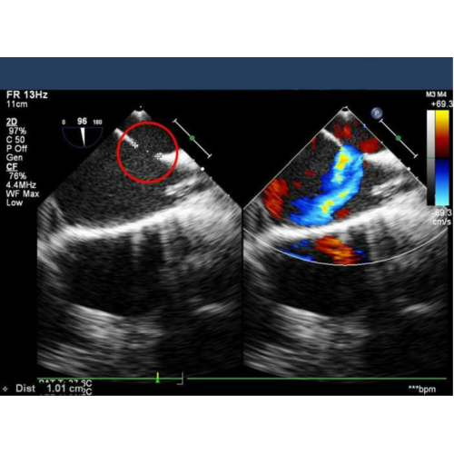 Cardiac Color Doppler Ultrasound Science Knowledge