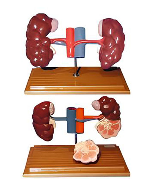 Anatomical model of bovine kidney