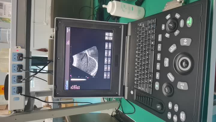 Video Ultrasound Laptop 7