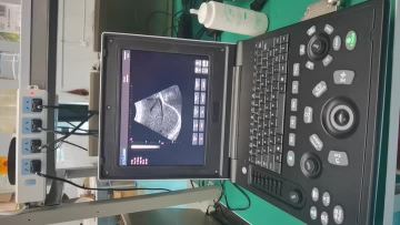 laptop ultrasounds video 7