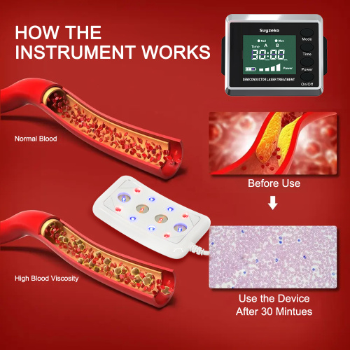 Manfaat jam tangan terapi laser tingkat rendah