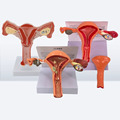 2025 New KRC Female Uterus and Ovary Anatomical Model1