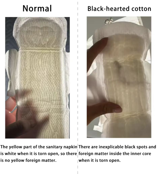Zehn Dinge, die Sie über die Sicherheit der Hygiene -Servietten wissen müssen ！！