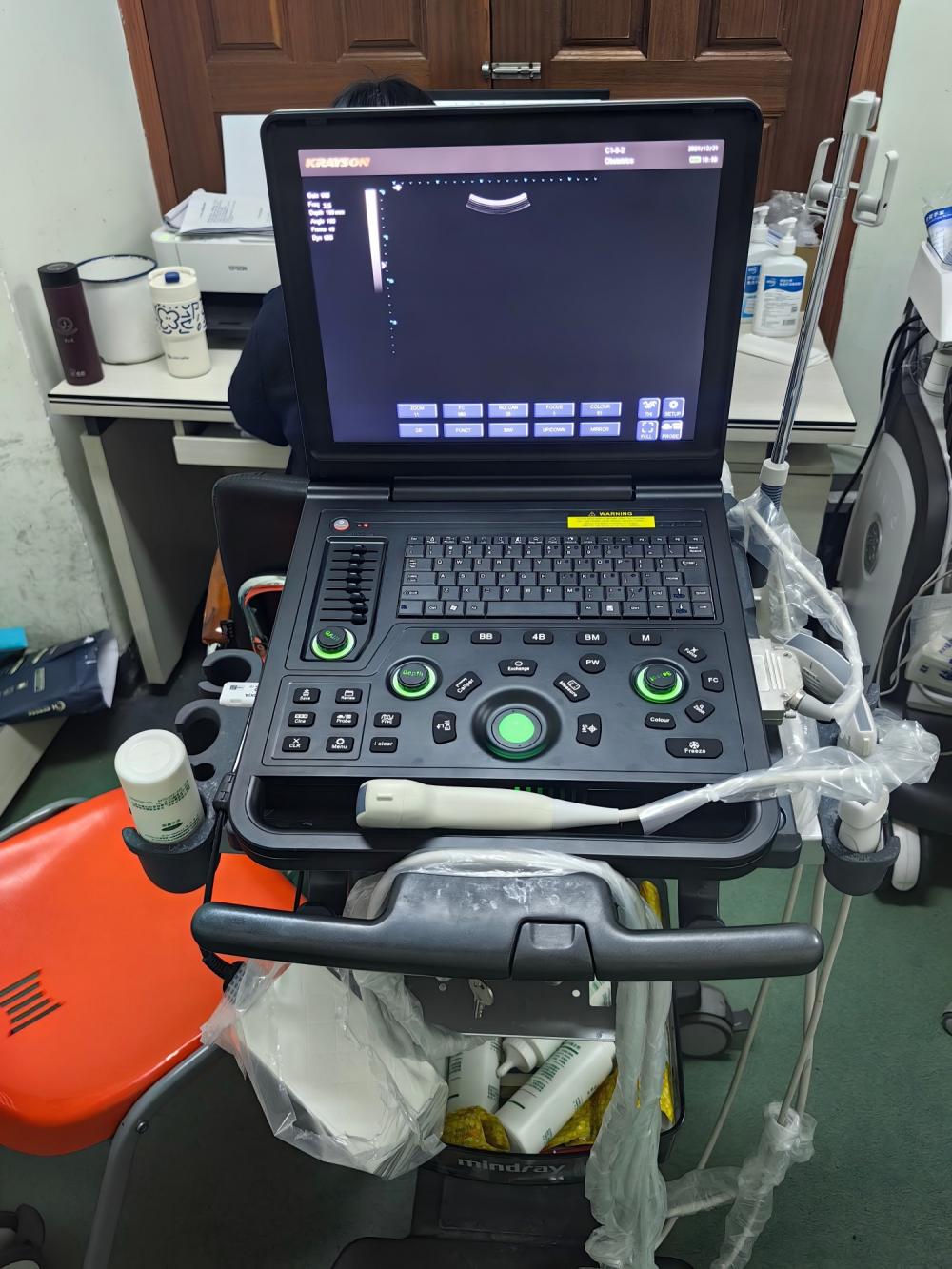 Hospital Ultrasound Application Scenarios