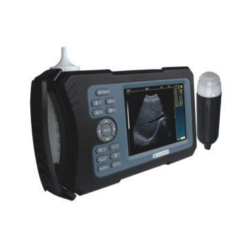 Ten Chinese Handheld Ultrasound Scanner Suppliers Popular in European and American Countries