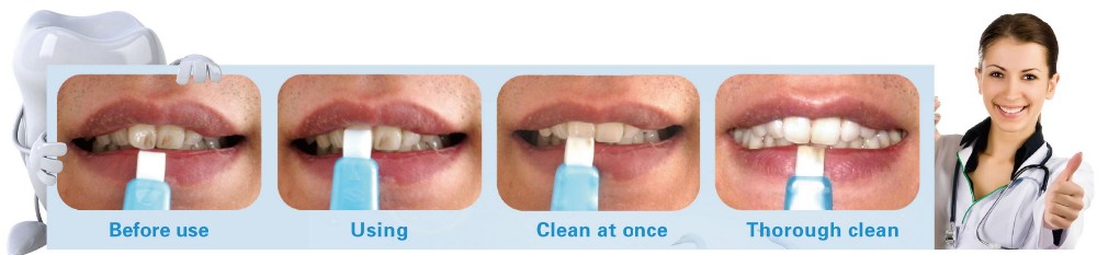 Hot Fashion Popular White Teeth Whitening Kits Tooth Whiten Remove Teeth Tartar Stains oral hygiene
