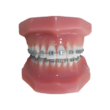 Asia's Top 10 Fixed Orthodontic Model Brand List