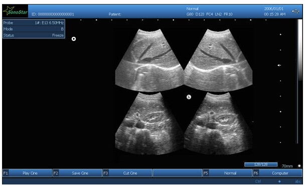 portable Ultrasound Box