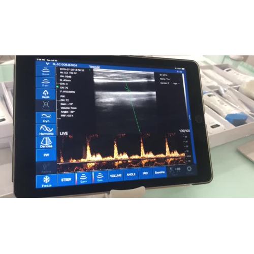 Funzione PW di uprobe-L6C