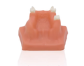 Dental Study Model Clinic Demonstration: Implant Model with Restoration and Implant Bridge1