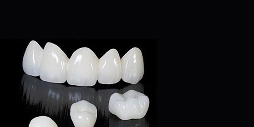 プロフェッショナルな製造